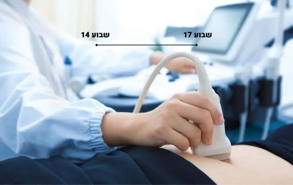 סקירת מערכות מוקדמת