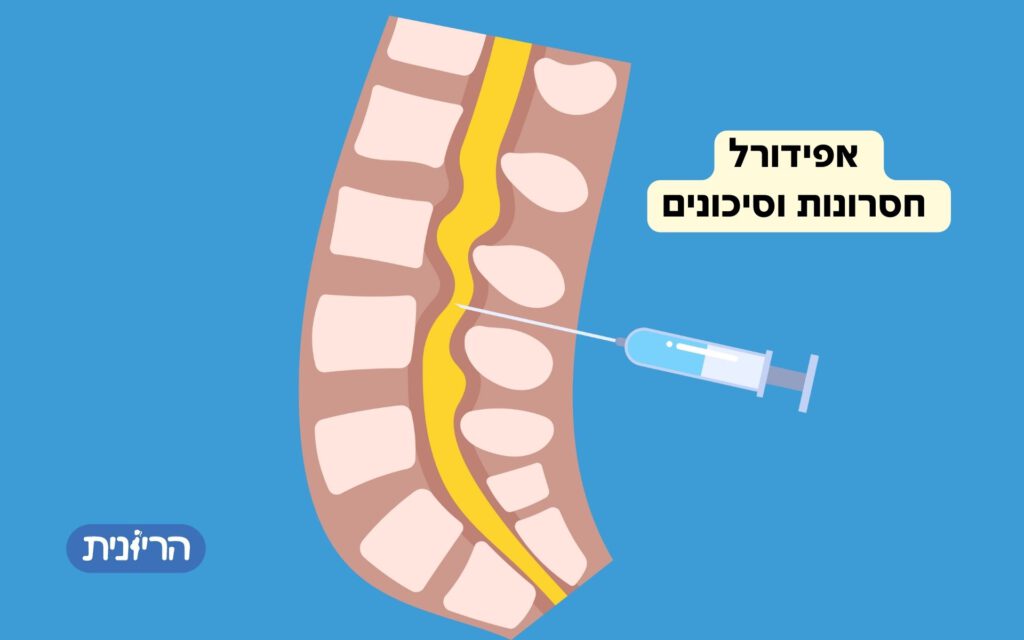 אפידורל חסרונות וסיכונים