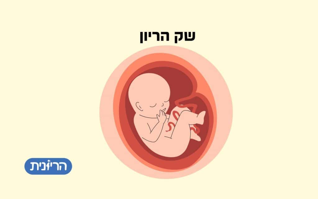 שק הריון