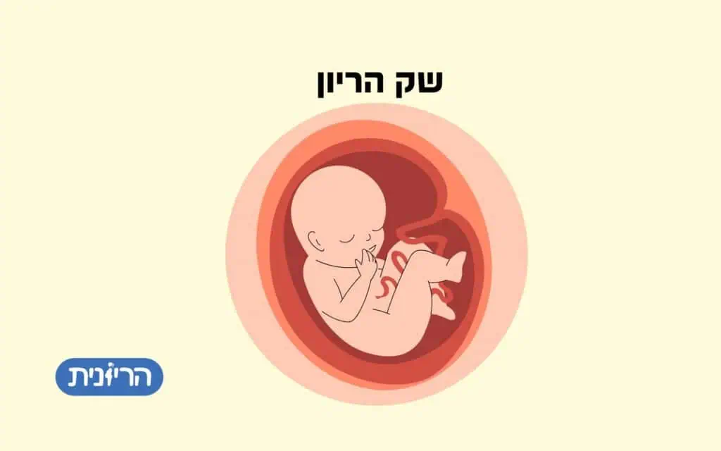 שק הריון